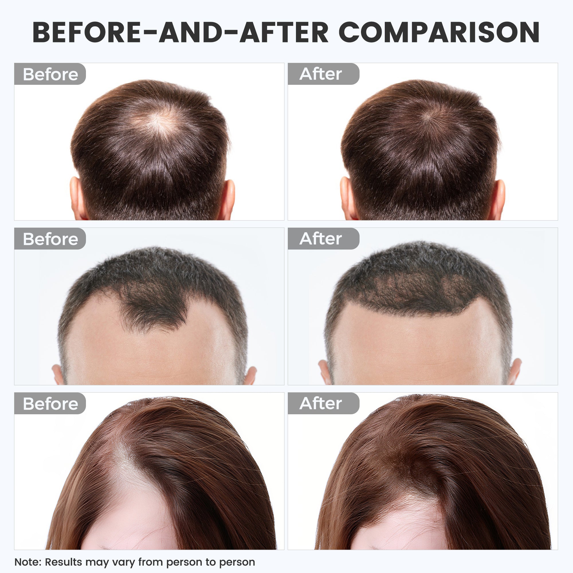 Red Light Therapy for Hair Growth: Cordless Red Light Heating Cap with 2000mAh Rechargeable Battery, Portable Care Tool for Home Use for Men & Women